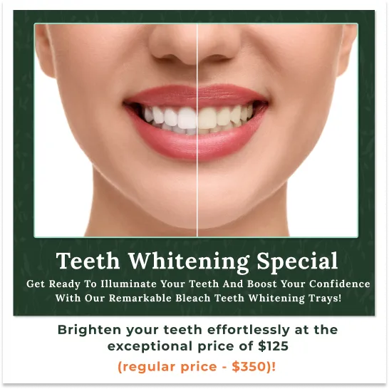 Teeth Whitening Special